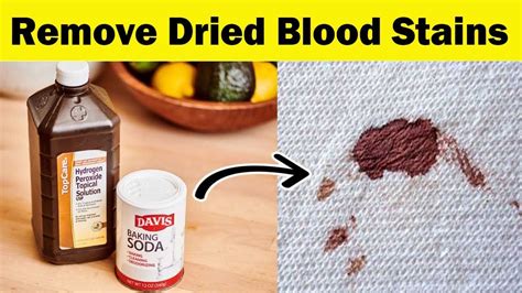 remove old blood stains.